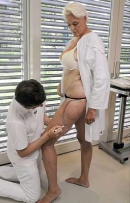 ITALIA 1 TORNA A STRIZZARE L’OCCHIO ALLA CHIRURGIA ESTETICA