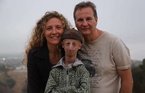 LA STORIA DI SAMMY BASSO, UN RAGAZZO SPECIALE