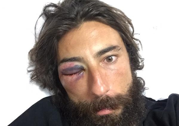 VITTORIO BRUMOTTI AGGREDITO (FOTO E VIDEO)