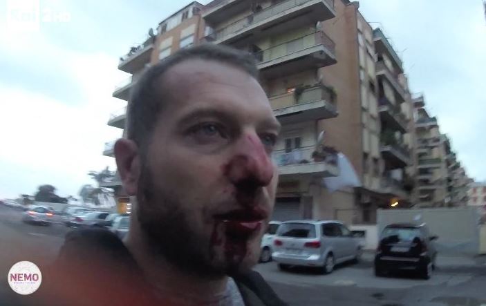 Roberto Spada aggredisce l’inviato di Nemo: violenza improvvisa, setto nasale rotto – Video