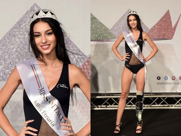Chiara Bordi, la prima Miss con protesi. E’ in gara a Miss Italia 2018