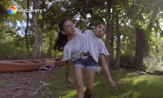 Due Sorelle Un Solo Corpo: su Real Time la storia delle gemelle siamesi Carmen e Lupita