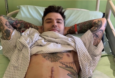 Fedez: «Ho scoperto di avere un raro tumore del pancreas. Dopo l’operazione, sto bene»
