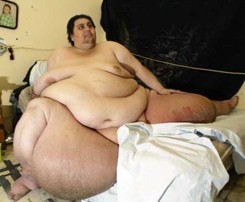 Manuel Uribe, l'uomo più grasso del mondo
